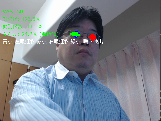 VAS値・左右瞳孔径・瞬き検出による計測